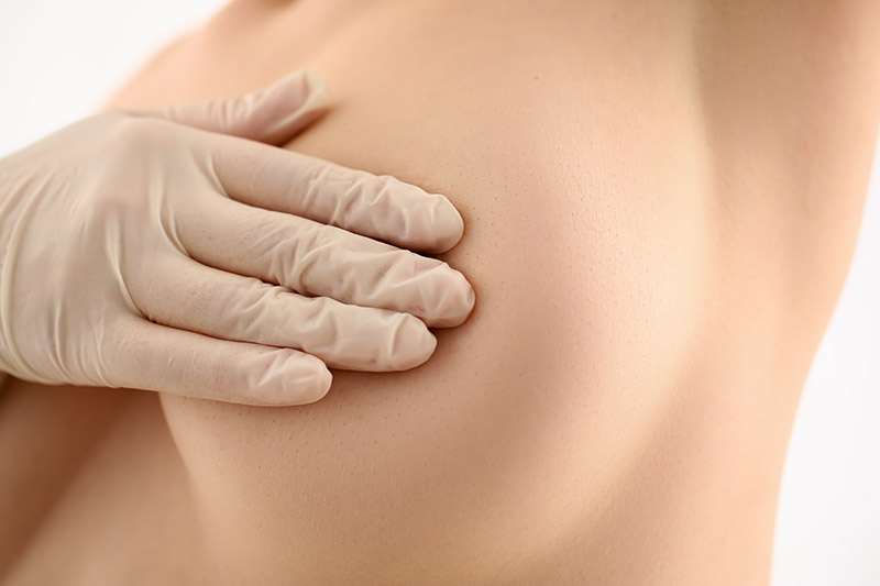 breast reduction surgeries in Antalya