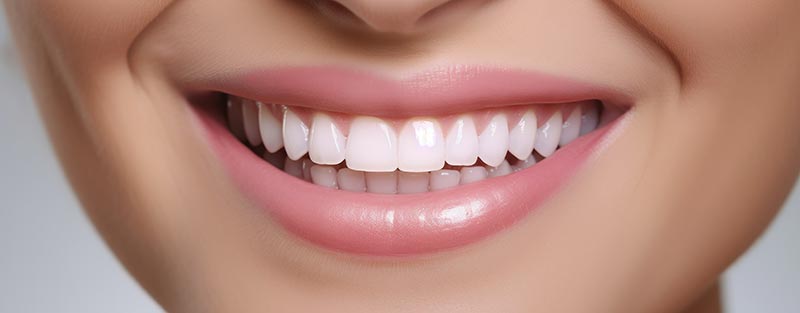 Zahnimplantate in Side