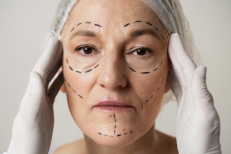 Why should you choose plastic surgery in Side?
