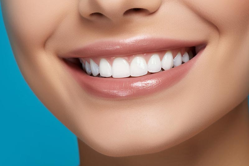 Dental implant treatment in Antalya Manavgat Side